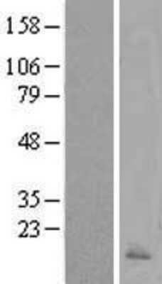 Western Blot: Calcitonin Overexpression Lysate [NBL1-08643]