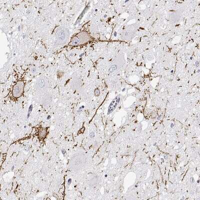 Immunohistochemistry-Paraffin: Calcitonin R Antibody [NBP1-88041]