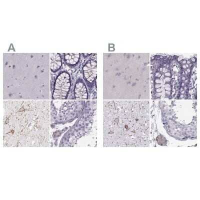 Immunohistochemistry-Paraffin: Calcitonin R Antibody [NBP1-88041]