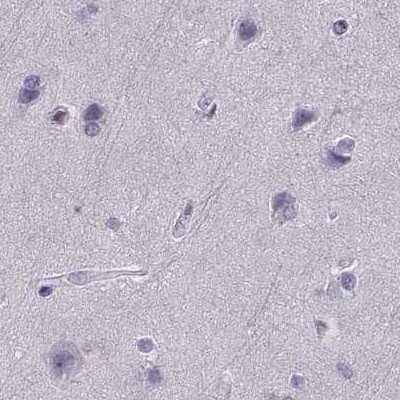 Immunohistochemistry-Paraffin: Calcitonin R Antibody [NBP1-88041]