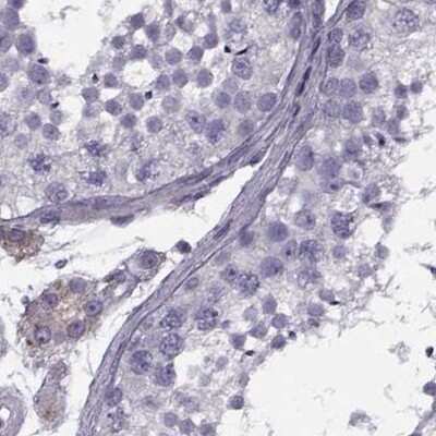Immunohistochemistry-Paraffin: Calcitonin R Antibody [NBP1-88041]
