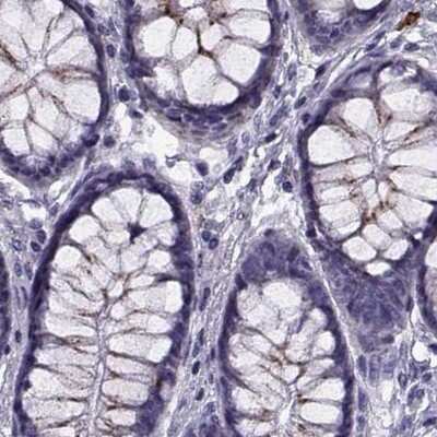 Immunohistochemistry-Paraffin: Calcitonin R Antibody [NBP1-88041]