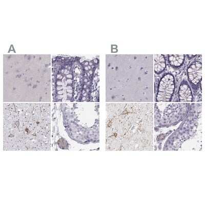 Immunohistochemistry-Paraffin: Calcitonin R Antibody [NBP2-68772]