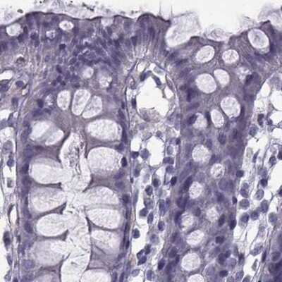 Immunohistochemistry-Paraffin: Calcitonin R Antibody [NBP2-68772]