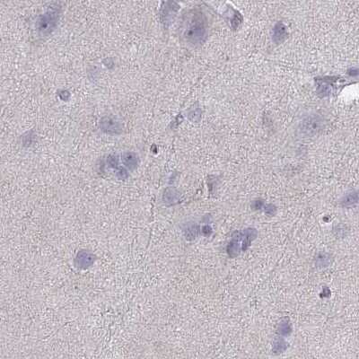 Immunohistochemistry-Paraffin: Calcitonin R Antibody [NBP2-68772]