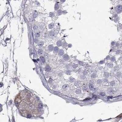 Immunohistochemistry-Paraffin: Calcitonin R Antibody [NBP2-68772]