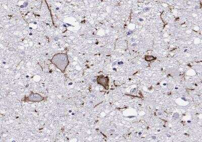 Immunohistochemistry-Paraffin: Calcitonin R Antibody [NBP2-68772]