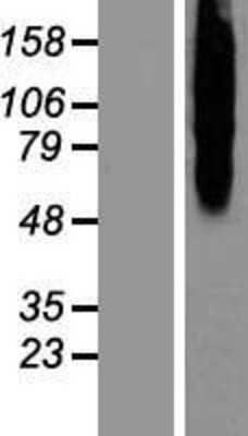 Western Blot: Calcitonin R Overexpression Lysate [NBP2-10768]