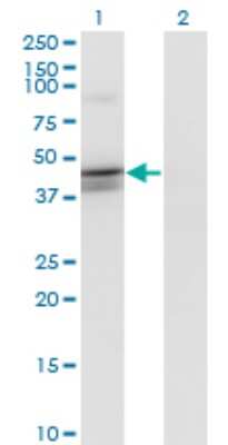 Western Blot: Calcium Activated Nucleotidase 1/CANT1 Antibody (1A1) [H00124583-M02]