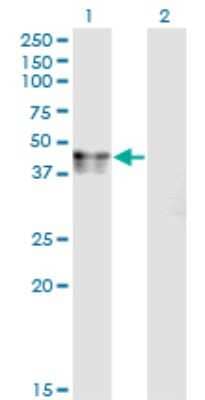 Western Blot: Calcium Activated Nucleotidase 1/CANT1 Antibody (2D3) [H00124583-M01]