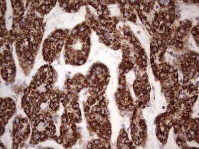 Immunohistochemistry: Calcium Activated Nucleotidase 1/CANT1 Antibody (OTI7F8) [NBP2-46056]