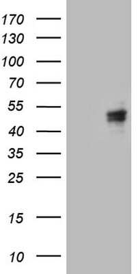 Western Blot: Calcium Activated Nucleotidase 1/CANT1 Antibody (OTI7F8) [NBP2-46056]