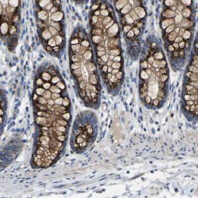 Immunohistochemistry-Paraffin: Calcium Activated Nucleotidase 1/CANT1 Antibody [NBP1-87081]