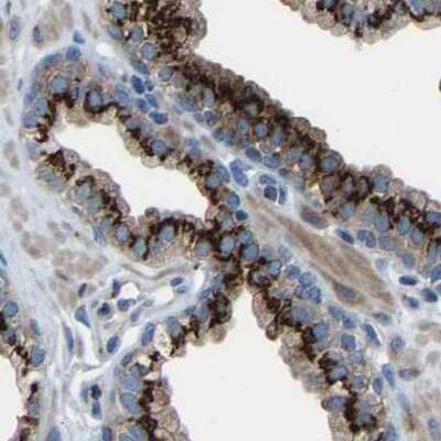 Immunohistochemistry-Paraffin: Calcium Activated Nucleotidase 1/CANT1 Antibody [NBP1-87081]