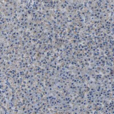 Immunohistochemistry-Paraffin: Calcium Activated Nucleotidase 1/CANT1 Antibody [NBP1-87082]
