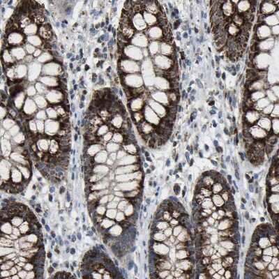 Immunohistochemistry-Paraffin: Calcium Activated Nucleotidase 1/CANT1 Antibody [NBP1-87082]