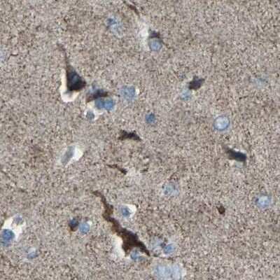 Immunohistochemistry-Paraffin: Calcium Activated Nucleotidase 1/CANT1 Antibody [NBP1-87082]