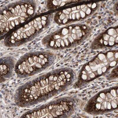 Immunohistochemistry-Paraffin: Calcium Activated Nucleotidase 1/CANT1 Antibody [NBP1-87083]