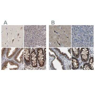 Immunohistochemistry-Paraffin: Calcium Activated Nucleotidase 1/CANT1 Antibody [NBP1-87083]