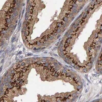 Immunohistochemistry-Paraffin: Calcium Activated Nucleotidase 1/CANT1 Antibody [NBP1-87083]