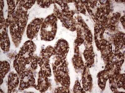 Immunohistochemistry: Calcium Activated Nucleotidase 1/CANT1 Antibody (OTI7F8) - Azide and BSA Free [NBP2-72378]