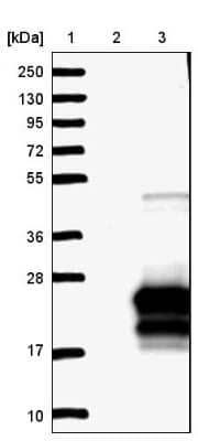 Western Blot: Calcium Channel Flower Homolog Antibody [NBP1-84307]