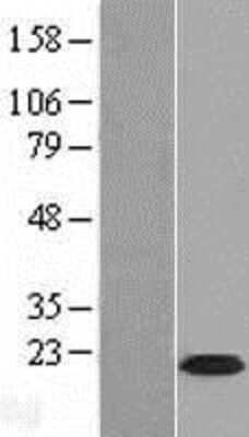 Western Blot: Calcium Channel Flower Homolog Overexpression Lysate [NBL1-08599]