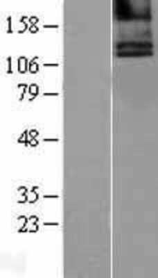 Western Blot: Calcium-sensing R/CaSR Overexpression Lysate [NBL1-08721]