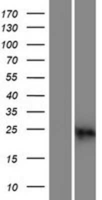 Western Blot: Calcium binding protein 2 Overexpression Lysate [NBP2-07040]