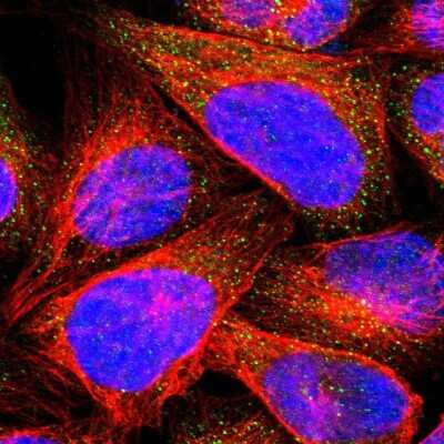 Immunocytochemistry/ Immunofluorescence: Calcium-binding-protein-P22 Antibody [NBP1-87589]