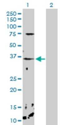 Western Blot: Calcium-binding-protein-P22 Antibody [H00011261-D01P]