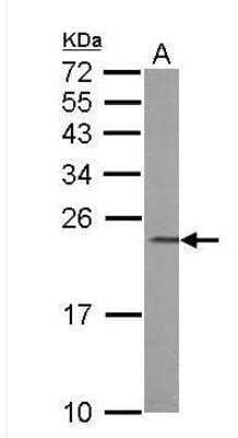 Western Blot: Calcium-binding-protein-P22 Antibody [NBP1-33736]