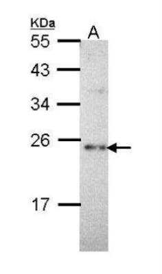 Western Blot: Calcium-binding-protein-P22 Antibody [NBP2-53090]