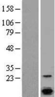 Western Blot: Calcium-binding-protein-P22 Overexpression Lysate [NBL1-09168]