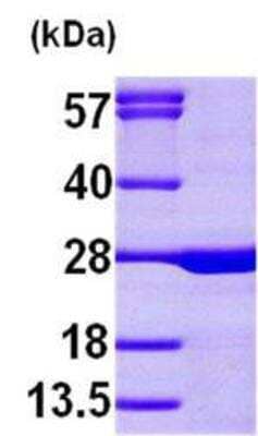 Western Blot: Recombinant Human Calcium-binding-protein-P22 His Protein [NBP1-45262]