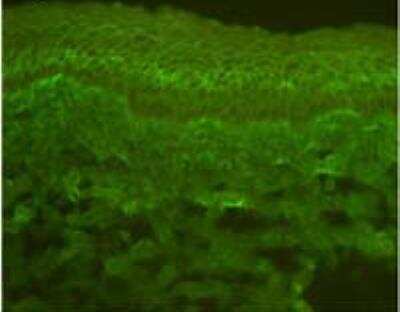 Immunocytochemistry/ Immunofluorescence: Calcium-sensing R/CaSR Antibody (5C10, ADD) - BSA Free [NB120-19347]