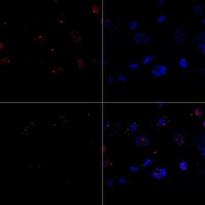 Immunocytochemistry/ Immunofluorescence: Calcium-sensing R/CaSR Antibody (5C10, ADD) - BSA Free [NB120-19347]