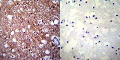 Immunohistochemistry-Paraffin: Calcium-sensing R/CaSR Antibody (5C10, ADD) - BSA Free [NB120-19347]