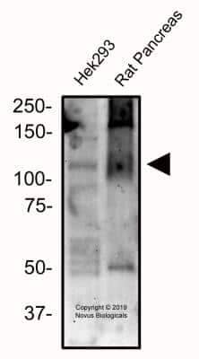 Western Blot: Calcium-sensing R/CaSR Antibody (5C10, ADD)BSA Free [NB120-19347]