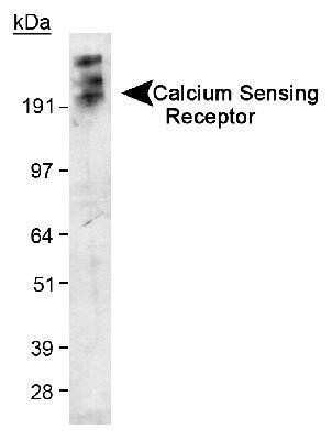 Western Blot: Calcium-sensing R/CaSR Antibody (HL 1499)Azide and BSA Free [NBP2-80607]