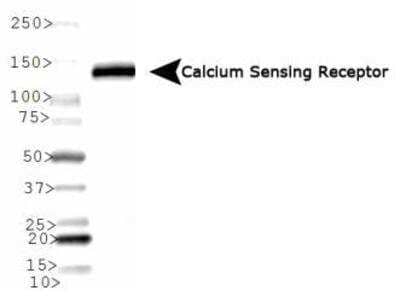 Western Blot: Calcium-sensing R/CaSR Antibody (HL 1499)BSA Free [NB100-1830]
