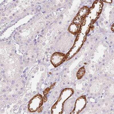 Immunohistochemistry-Paraffin: Calcium-sensing R/CaSR Antibody [NBP1-84687]