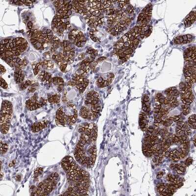 Immunohistochemistry-Paraffin: Calcium-sensing R/CaSR Antibody [NBP1-84687]