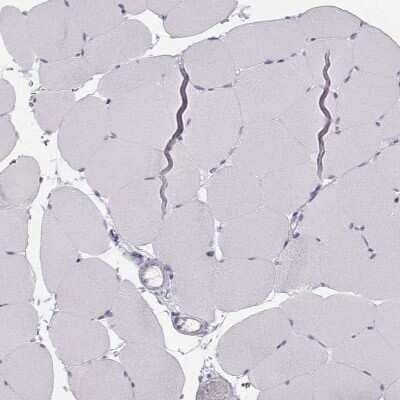 Immunohistochemistry-Paraffin: Calcium-sensing R/CaSR Antibody [NBP1-84687]