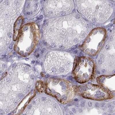 Immunohistochemistry-Paraffin: Calcium-sensing R/CaSR Antibody [NBP1-84687]