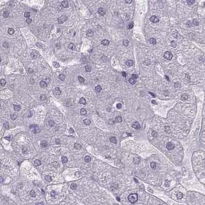 Immunohistochemistry-Paraffin: Calcium-sensing R/CaSR Antibody [NBP1-84687]