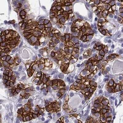Immunohistochemistry-Paraffin: Calcium-sensing R/CaSR Antibody [NBP1-84687]