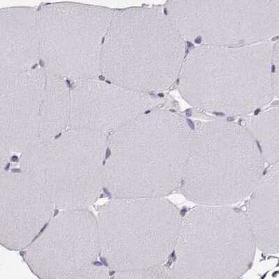 Immunohistochemistry-Paraffin: Calcium-sensing R/CaSR Antibody [NBP1-84687]