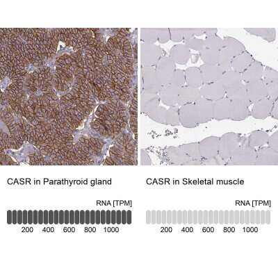 Immunohistochemistry-Paraffin: Calcium-sensing R/CaSR Antibody [NBP1-84687]