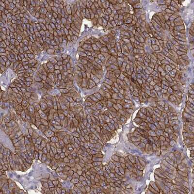 Immunohistochemistry-Paraffin: Calcium-sensing R/CaSR Antibody [NBP1-84687]